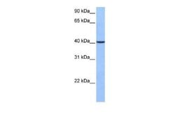 AGBL5 Rabbit anti-Human, Polyclonal, Novus Biologicals:Antibodies:Primary